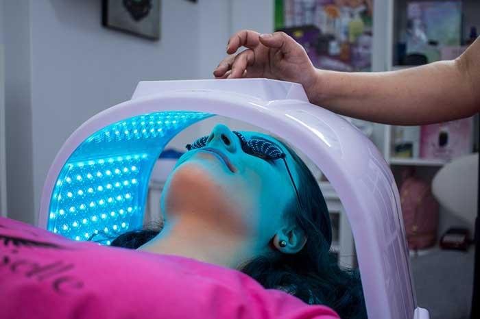 facial laser treatment