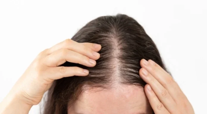 Natural vs. Pharmaceutical Hair Growth
