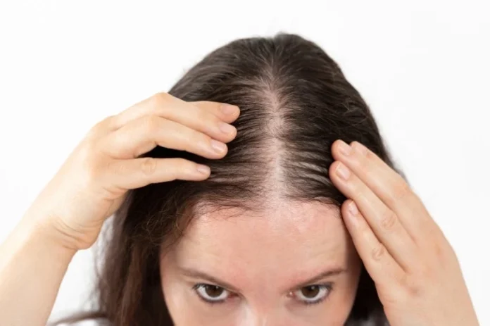 Natural vs. Pharmaceutical Hair Growth
